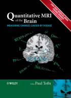Quantitative MRI of the Brain - Measuring ChangesCaused by Disease
