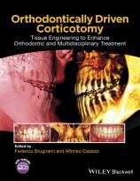 Orthodontically Driven Corticotomy: Tissue Engineering to Enhance Orthodontic and MultidisciplinaryTreatment
