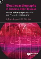Electrocardiography in Ischemic Heart Disease -Clinical and Imaging Correlations and PrognosticImplications